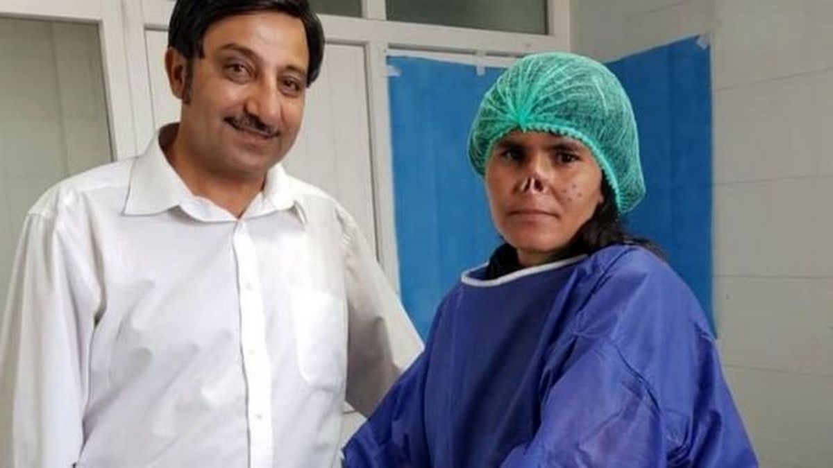مردی با چاقو بینی همسرش را برید + تصاویر