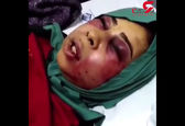 شکنجه دردناک زن زرندی توسط شوهرش+عکس