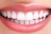 روش داشتن دندان هایی سفید و زیبا